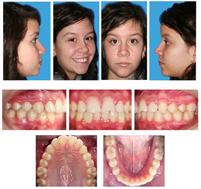 Fig Posttreatment Facial And Intraoral Photographs