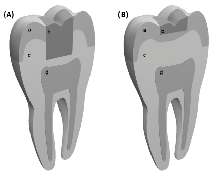 Temperature Rise at the Pulp-Dentin Junction for a Multi-Layered Composite  Restoration using the Finite Element Method